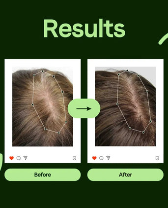 Scandinavian Biolabs Bio-Pilixin amaciador homem (250 ml) Scandinavian Biolabs Bio-Pilixin conditioner men (250 ml) - Hairgivers