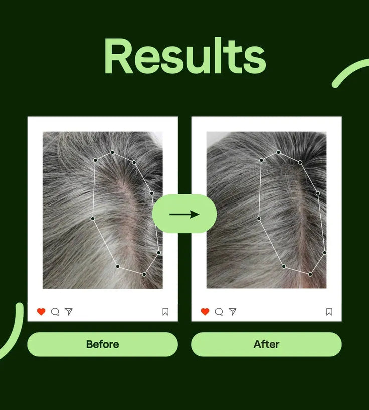 Scandinavian Biolabs Bio-Pilixin conditioner women (250 ml) - Hairgivers