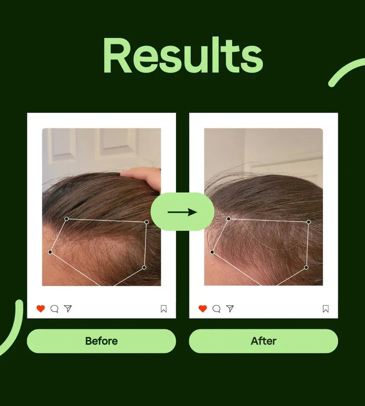 Scandinavian Biolabs Bio-Pilixin serum men (100 ml) - Hairgivers