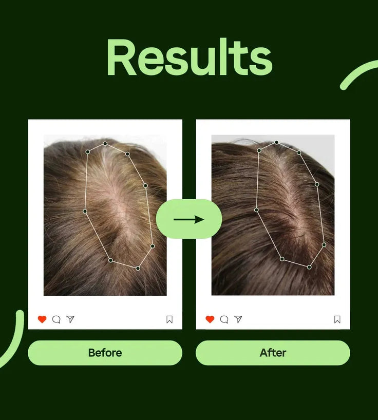 Scandinavian Biolabs Bio-Pilixin serum men (100 ml) - Hairgivers