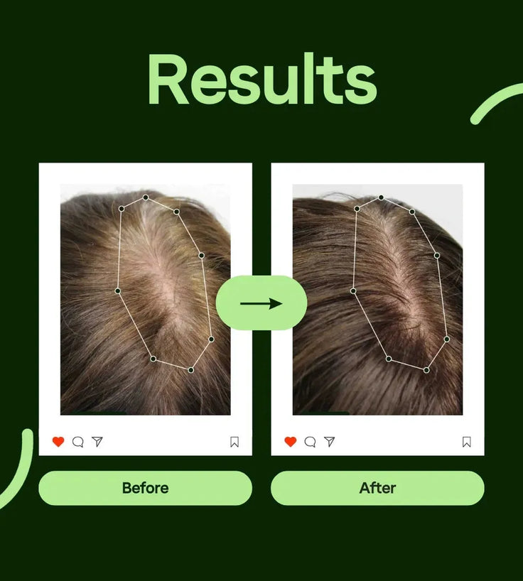 Scandinavian Biolabs Bio-Pilixin serum women (100 ml) - Hairgivers