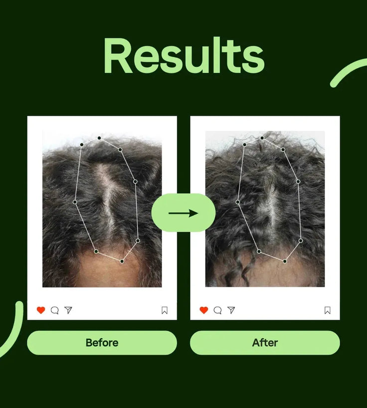 Scandinavian Biolabs Bio-Pilixin serum women (100 ml) - Hairgivers