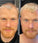 Scandinavian Biolabs hair growth treatment (men) - Hairgivers