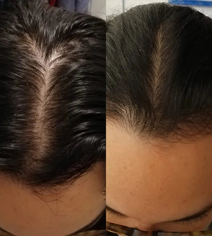 Scandinavian Biolabs hair growth treatment (women) - Hairgivers