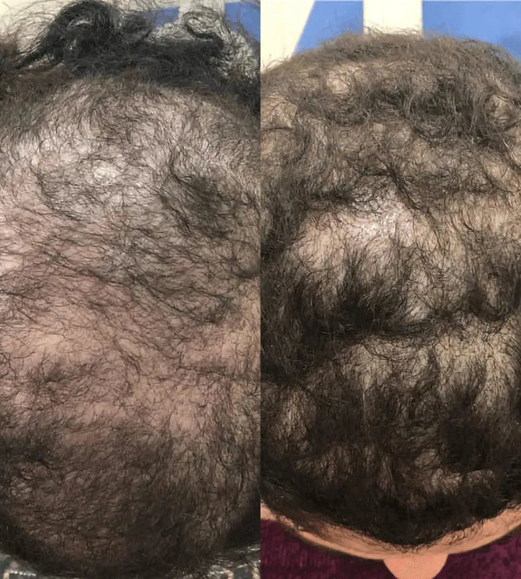 Spectral.CSF (Adenosine) lotion - Hairgivers