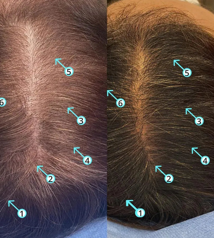 Spectral.DNC-S (Melanex) lotion - Hairgivers