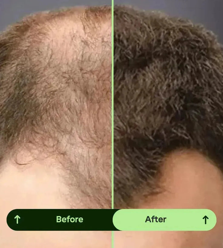 Toppik hair thickener color spray - black - Hairgivers