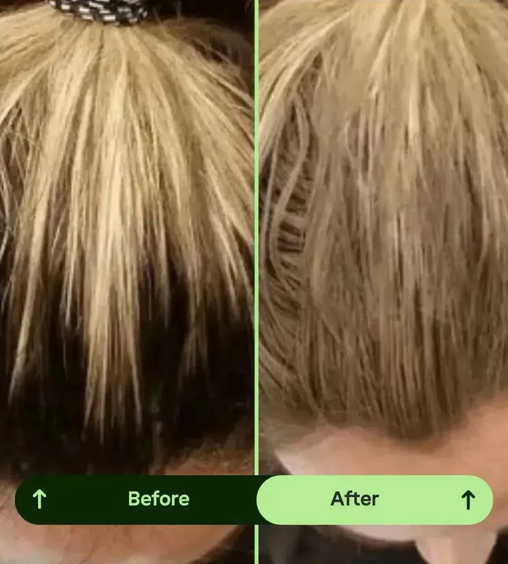 Toppik hair thickener color spray - black - Hairgivers