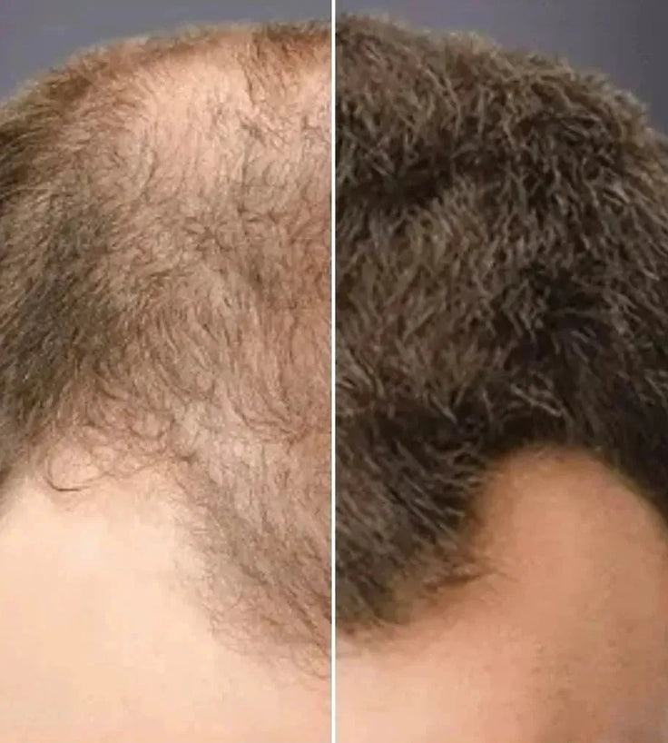 Toppik hair thickener color spray - Hairgivers