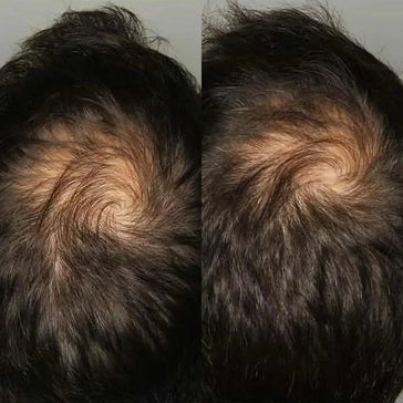 Compresse Viviscal per la crescita dei capelli per uomo (1 mese) Viviscal hair growth tablets for men (1 month) - Hair Growth Specialist