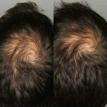 Comprimés Viviscal pour la croissance des cheveux chez les hommes (1 mois) Viviscal hair growth tablets for men (1 month) - Hairgivers