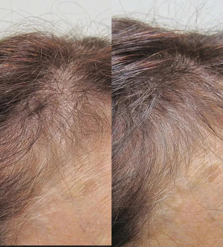 Viviscal hair growth tablets for women (3 months) - Hairgivers