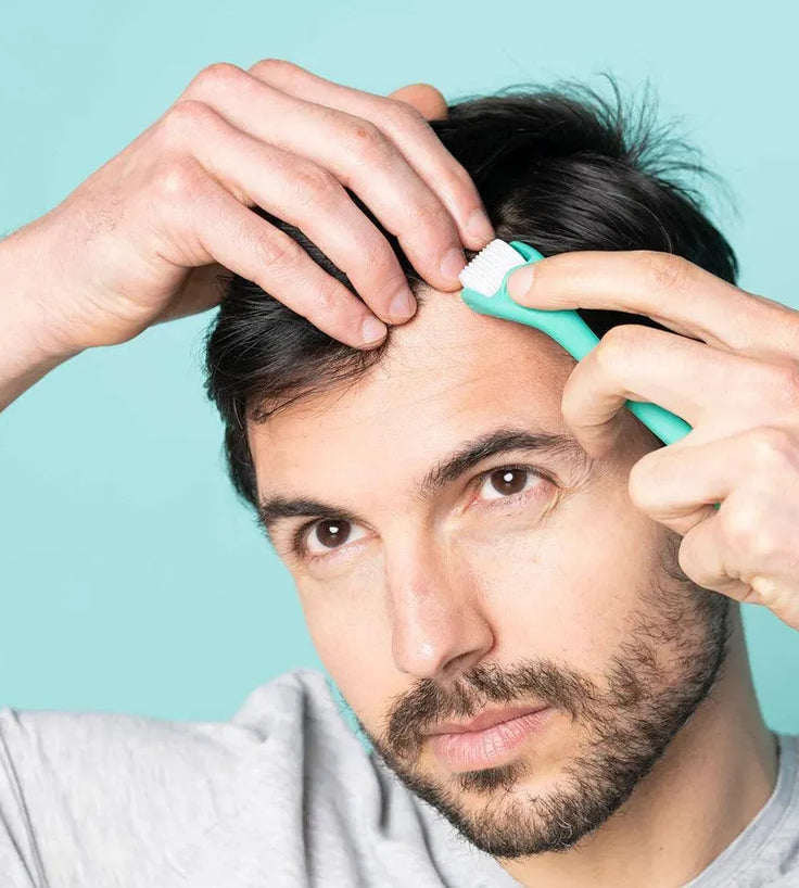 Neofollics scalp roller (0.3 mm) - Hairgivers