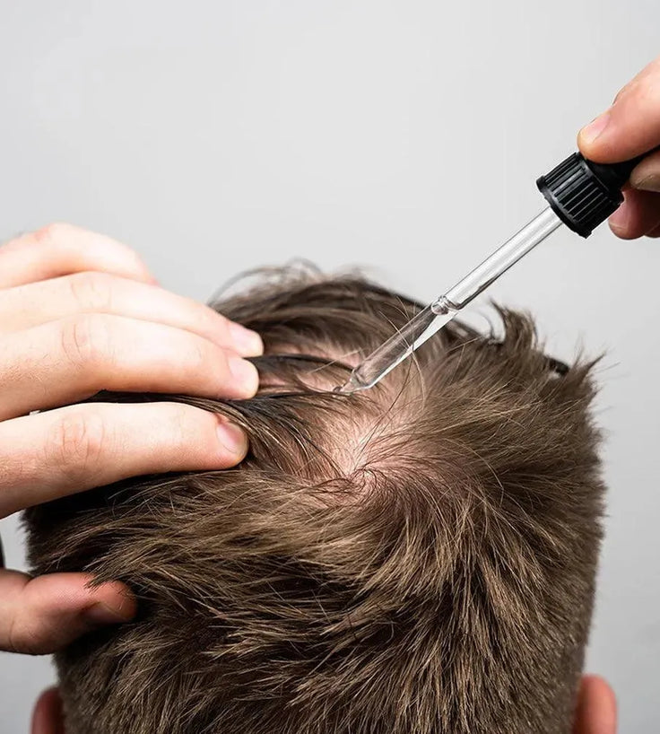 Scandinavian Biolabs Bio-Pilixin serum men (100 ml) - Hairgivers