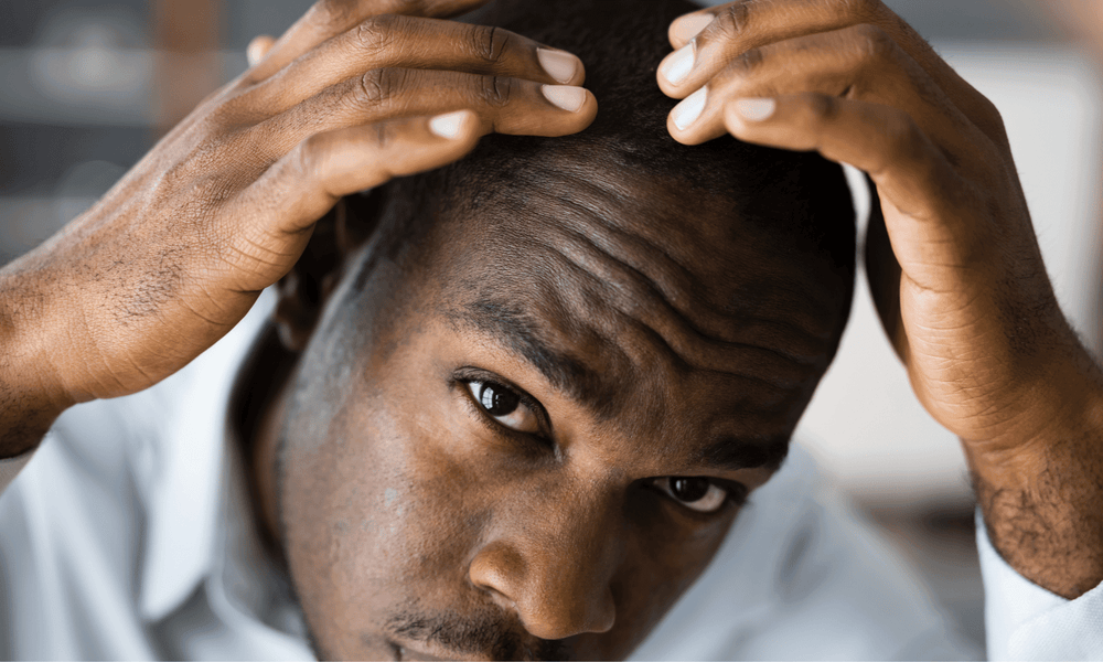 Advice on hair problems