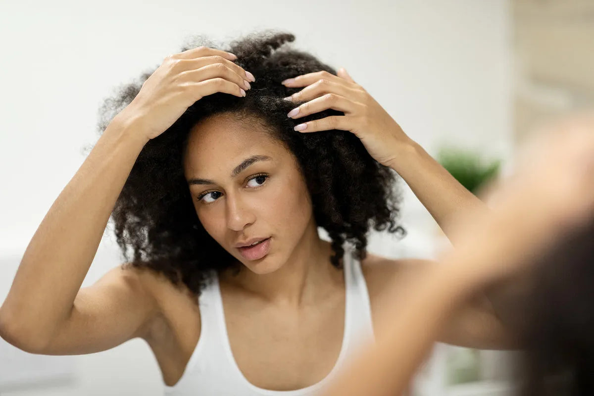 Alopecia prematura