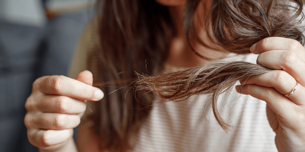 Sudden severe hair loss in women