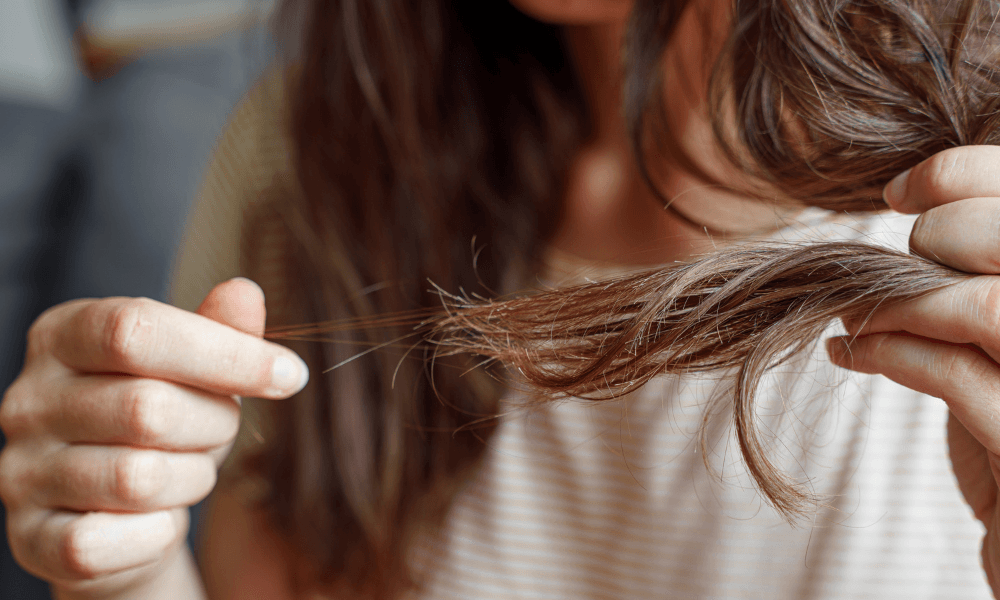 Plötsligt kraftigt håravfall hos kvinnor
