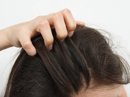 ¿Padece psoriasis en el cuero cabelludo? Descubra las causas y las soluciones