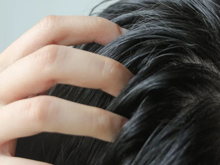 Ihanteellinen kuorinta päänahan ongelmiin