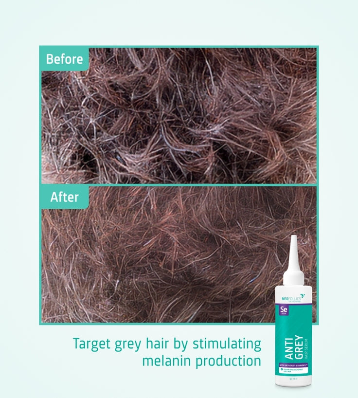 Kit anti-gris Neofollics