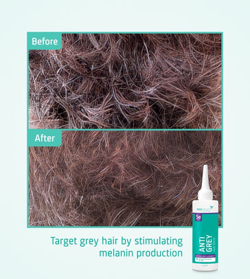 Neofollics anti-grey serum - Hairgivers