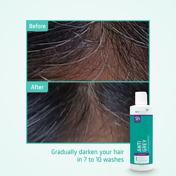 Shampoo antigrigio Neofollics