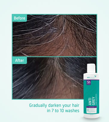 Neofollics anti-grey shampoo