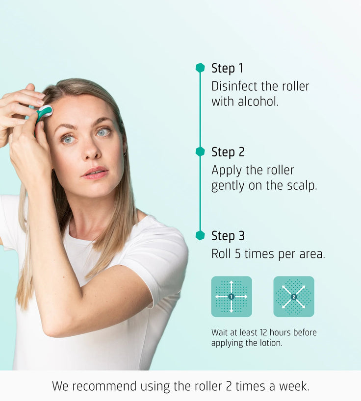 Neofollics scalp roller (0.3 mm)