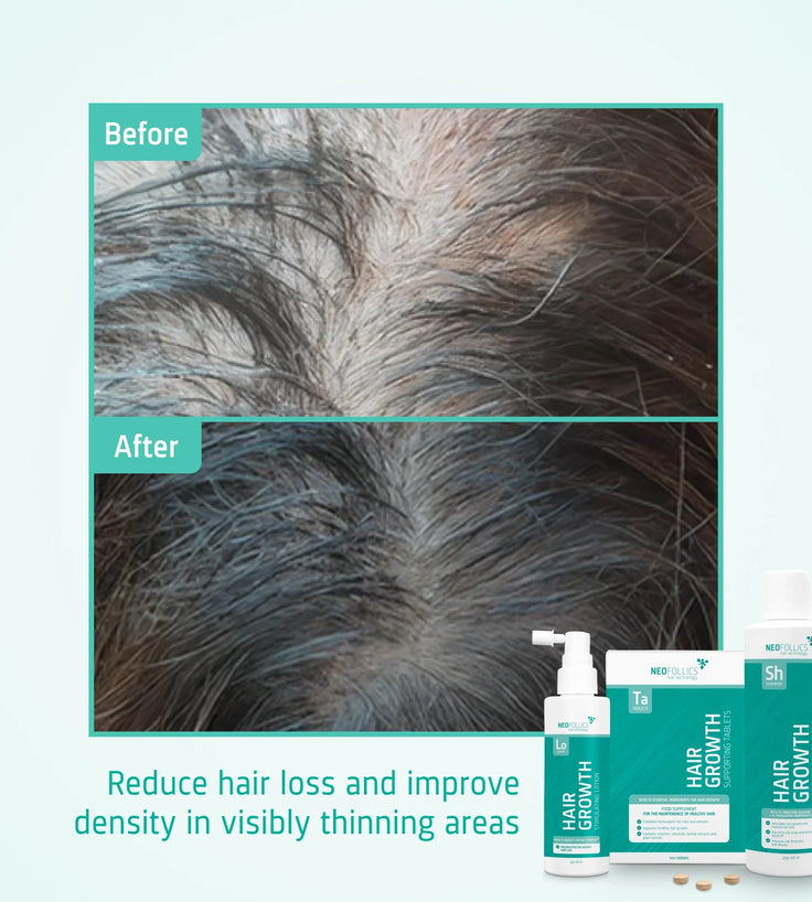 Neofollics Shampoo + Siero + Compresse