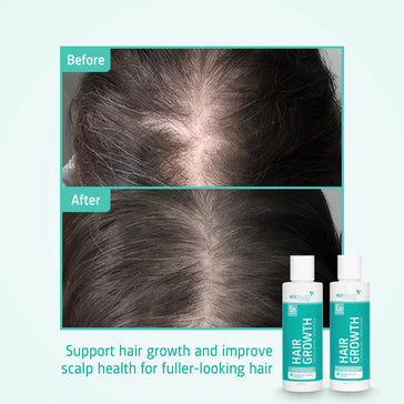 Neofollics hair growth shampoo + conditioner starter kit - Hairgivers