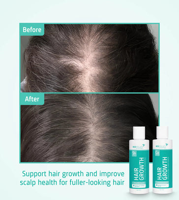 Neofollics hair growth shampoo + conditioner starter kit - Hairgivers