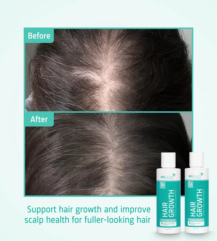 Neofollics hair growth shampoo + conditioner starter kit