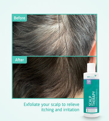Neofollics exfoliating shampoo Neofollics exfoliating shampoo - Hairgivers