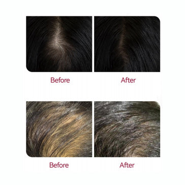 Beaver Anti-Hair Loss Shampoo