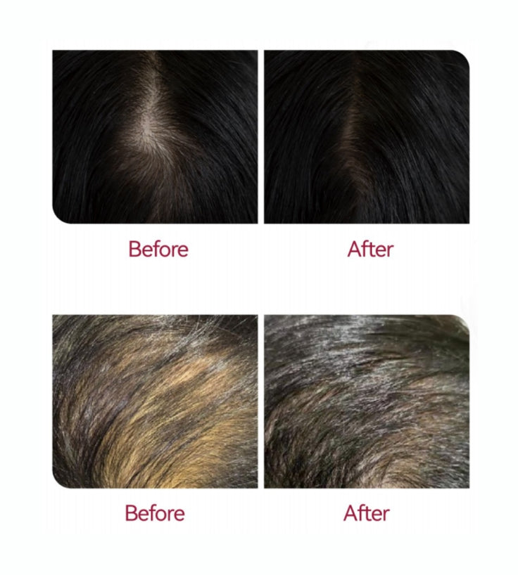 Beaver Anti-Hair Loss Shampoo + Serum + Applikator