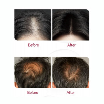 Beaver Anti-Hair Loss Shampoo + Serum + Applikator