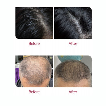 Beaver Anti-Hair Loss Serum