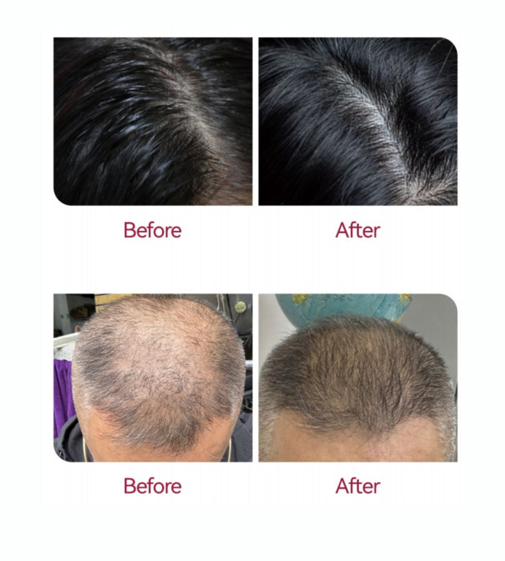 Beaver Anti-Hair Loss Shampoo + Serum + Applikator