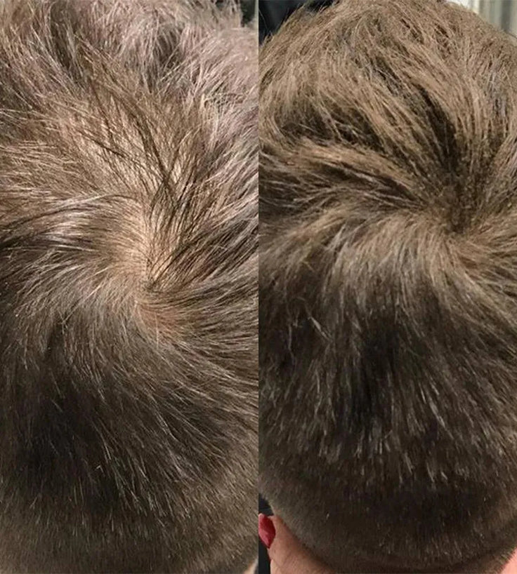 Beaver keratin hair building fibers - Auburn (28 gr) - Hairgivers