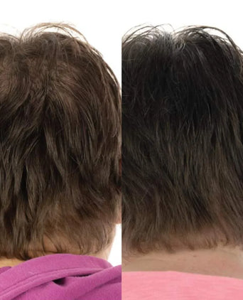 Foligain hair loss shampoo + conditioner women (236 ml) - Hair Growth Specialist