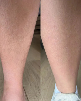 Keramene body hair minimizer depilatory cream - Hair Growth Specialist