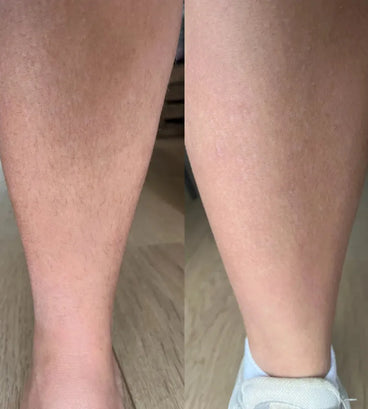 Keramene body hair minimizer depilatory cream - Hair Growth Specialist