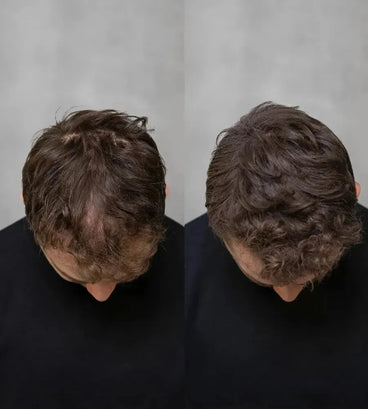 Keratain pomade + Keratain hair fibers - Hair Growth Specialist