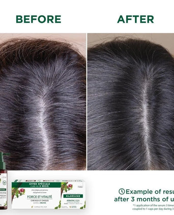 Klorane anti-hair loss serum Quinine/Edelweiss (100 ml) - Hair Growth Specialist