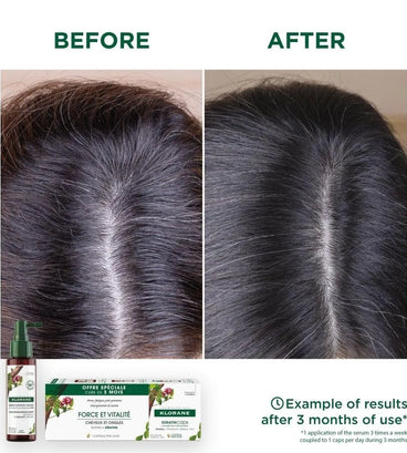 Klorane anti-hair loss serum Quinine/Edelweiss (100 ml) - Hair Growth Specialist
