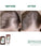 Klorane anti-hair loss shampoo + conditioner - Hair Growth Specialist