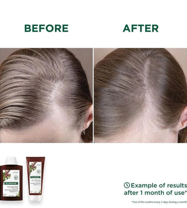 Klorane anti-hair loss shampoo + conditioner Klorane anti-hair loss shampoo + conditioner - Hairgivers
