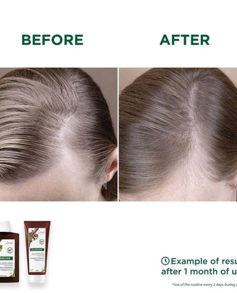 Klorane anti-hair loss shampoo Quinine/Edelweiss (200 ml) - Hair Growth Specialist