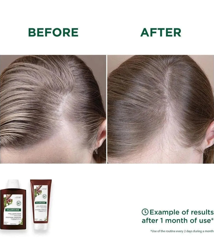 Klorane anti-hair loss shampoo Quinine/Edelweiss (200 ml) - Hairgivers